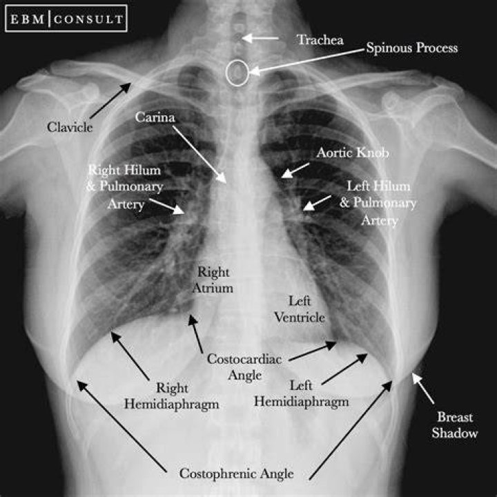 images/histmed/wwi/radiology-01.jpg chest x-ray