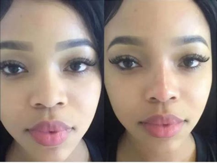 Faith Nketsi plastic surgery Faith Nketsi plastic surgery