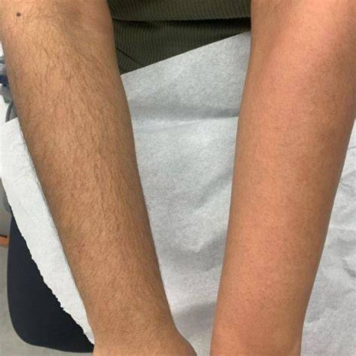 Here's How to Tame Your Hairy Back—Without Waxing