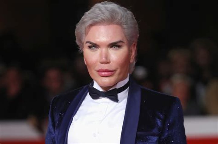 Human Ken Doll CAN'T STOP With Implants