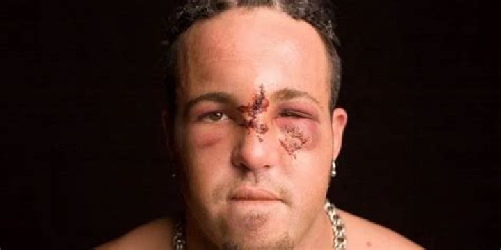 Joey Mercurys Face 