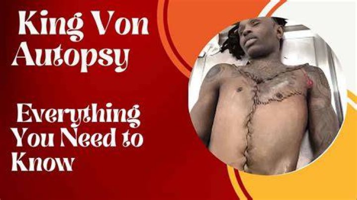 King Von Autopsy The Shocking Truth Behind His Death and Life