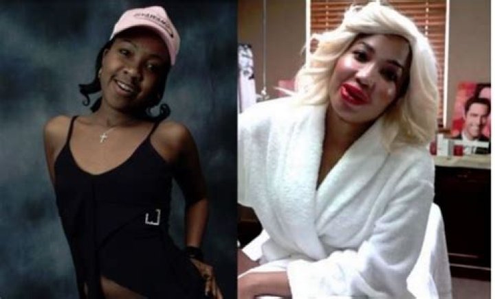 Mshoza plastic surgery Mshoza plastic surgery