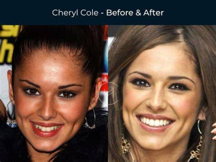 SA celebrities before and after plastic surgery SA celebrities before and after plastic surgery
