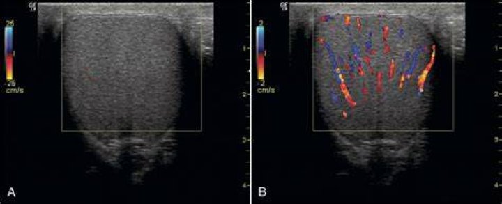 Understanding Normal Scrotum Color - Statcare