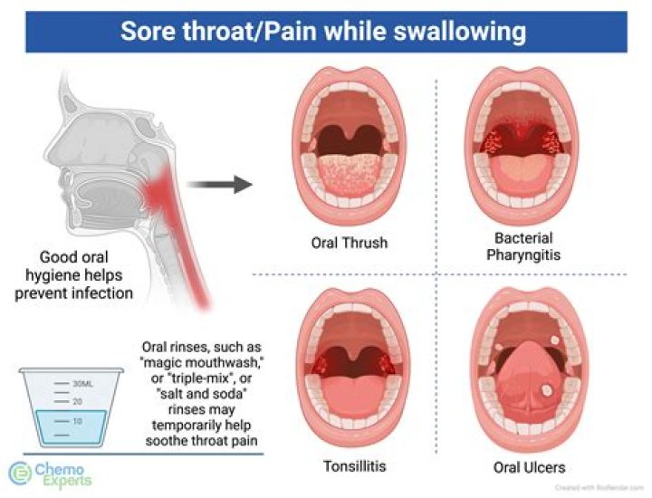 What Does It Mean When Your Throat Hurts