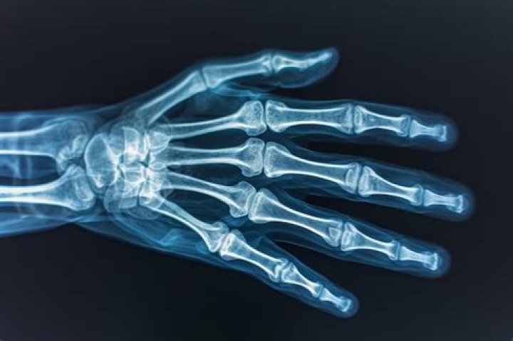 images/histmed/wwi/radiology-02.jpg x-ray